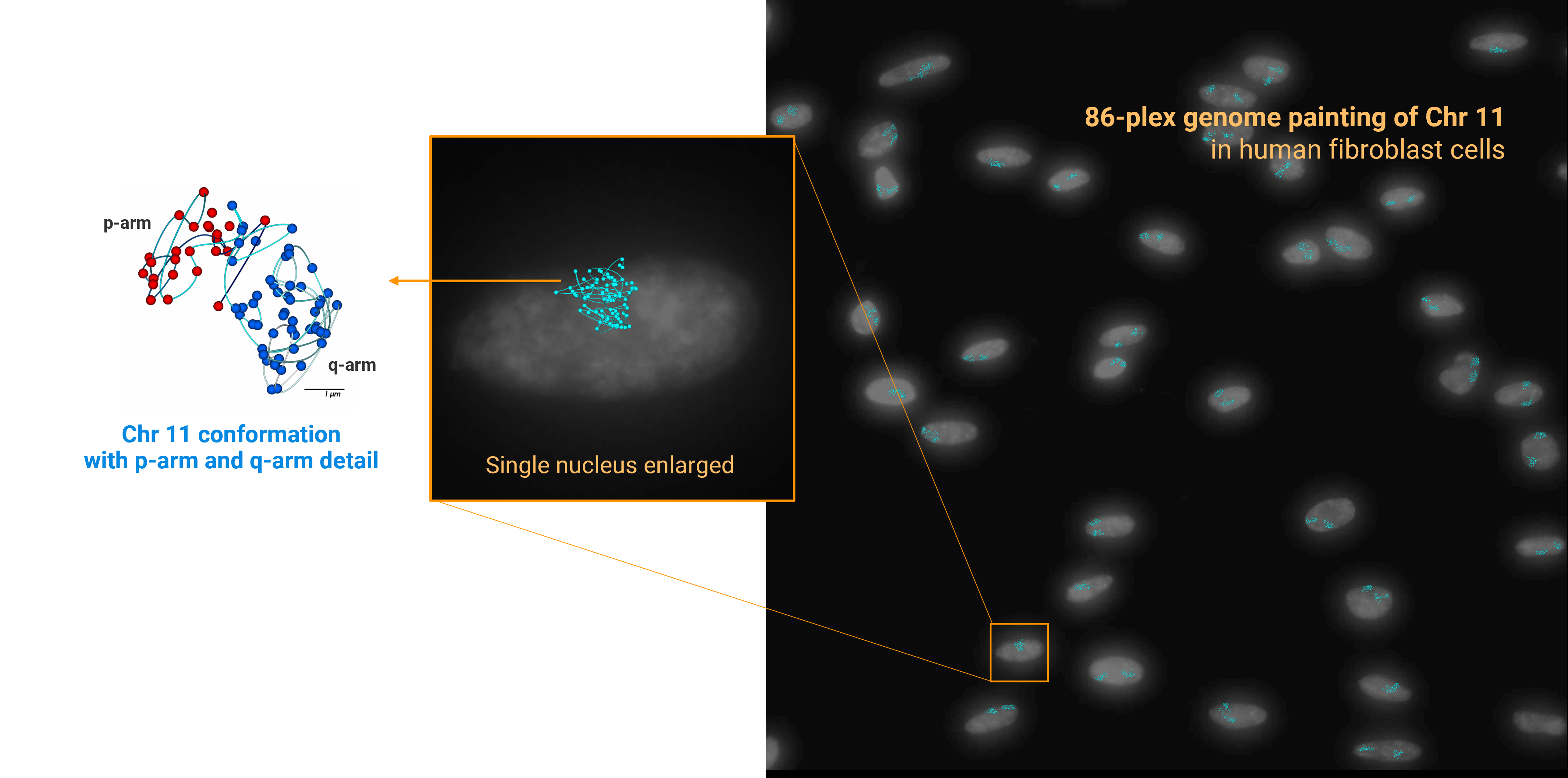PaintScape-chromotrace-pArm-qArm-Chr11A-zoomA jebFISH analysis of Chr 11 on human fibroblast cells with the PaintScape™ System