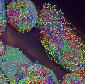 IMG-PaintScape-chromotrace-FF-CRC-all-chr-FOV96 PaintScape on fresh frozen CRC tissue