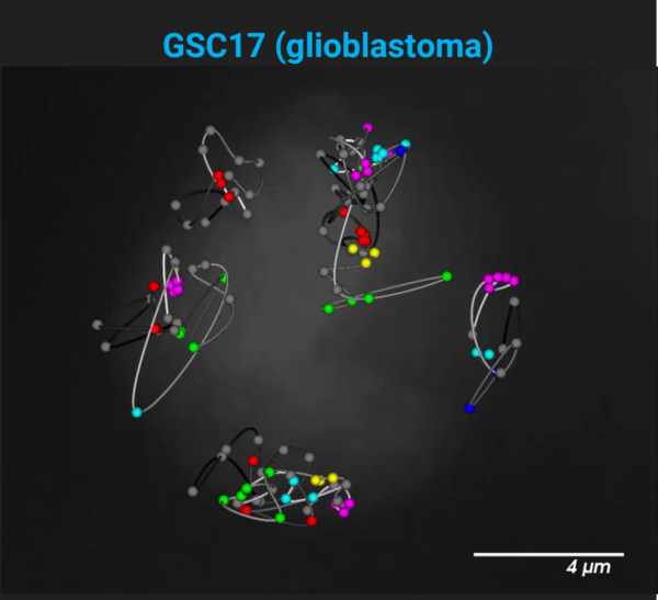 ploidy variation in a glioblastoma cell line visualized with jebFISH on PaintScape